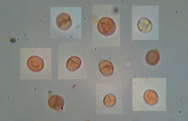 Asterostroma laxum Bres. (1920)
